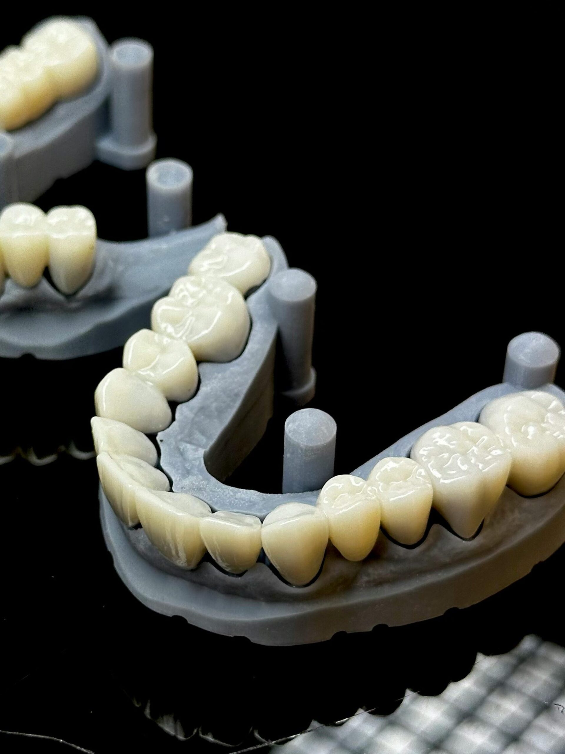 pexels-photo-33800640-33800640 Close-up of 3D printed dental models showcasing realistic tooth replicas for dental restoration purposes.