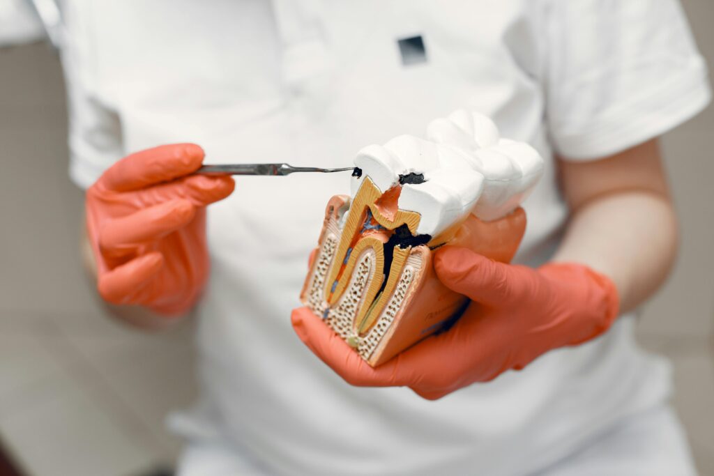 pexels-photo-4971514-4971514 Close-up of dentist holding a tooth model, illustrating dental care concepts.