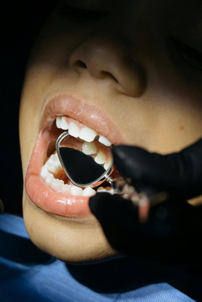 pexels-photo-6502546-6502546 Close-up of a child's mouth during a dental examination with a mouth mirror.
